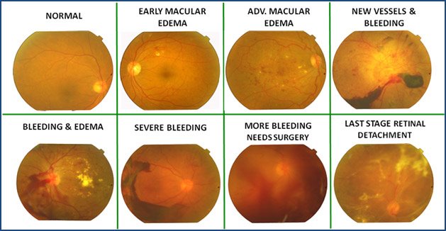 Save Chris's Eyesight - Diabetes by Sarah Foy White - GoFundMe