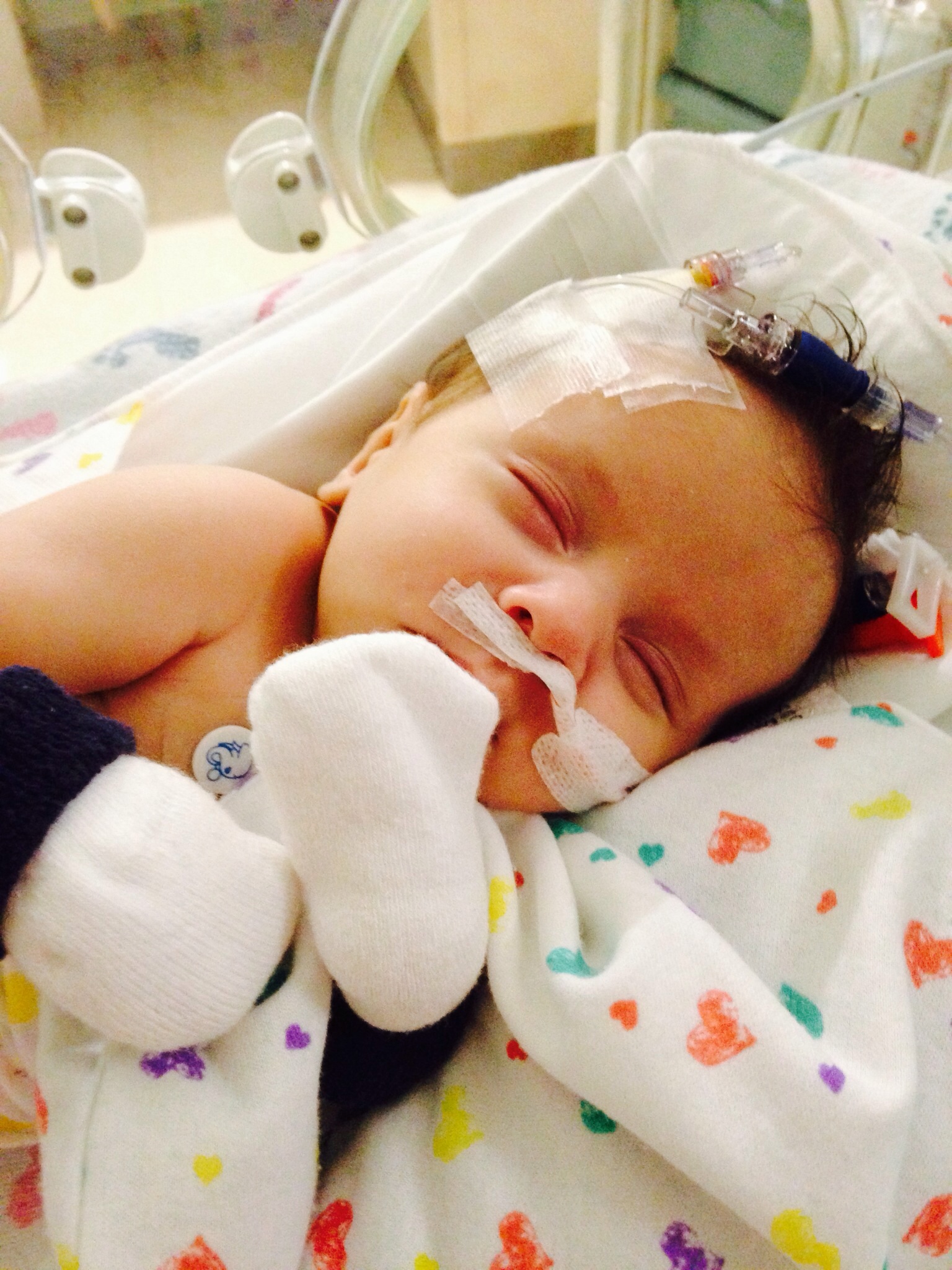 Fundraiser by Tami Steffens Leone Miracle baby surviving Potters